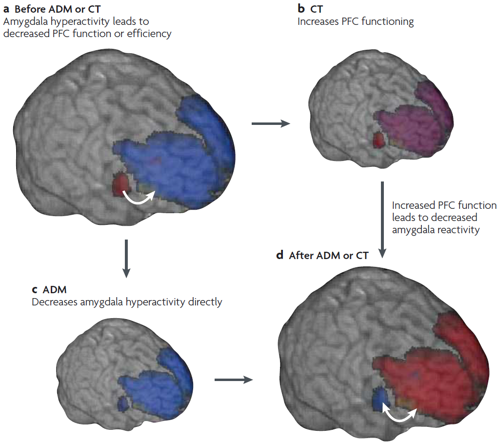 Hypothetical time course of the changes to amygdala and prefrontal function that are associated with antidepressant medication and cognitive therapy, illustrating major cognitive therapy neural networks